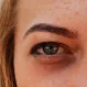 How Do You Get Rid of Puffiness Under the Eyes?