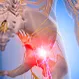 Back Pain: How to Ease Sciatic Nerve Pain