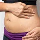 How Can I Avoid Stretch Marks on My Stomach During Pregnancy?
