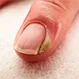 19 Nail Changes That You Should Not Ignore