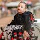 How Common Is Spinal Muscular Atrophy?