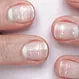What Does It Mean if Your Nails Are White?