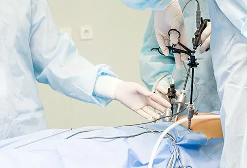 How Long Does It Take to Recover From Laparoscopic Surgery?